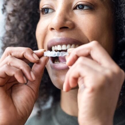 aparelho transparente