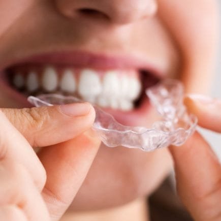 invisalign e bruxismo
