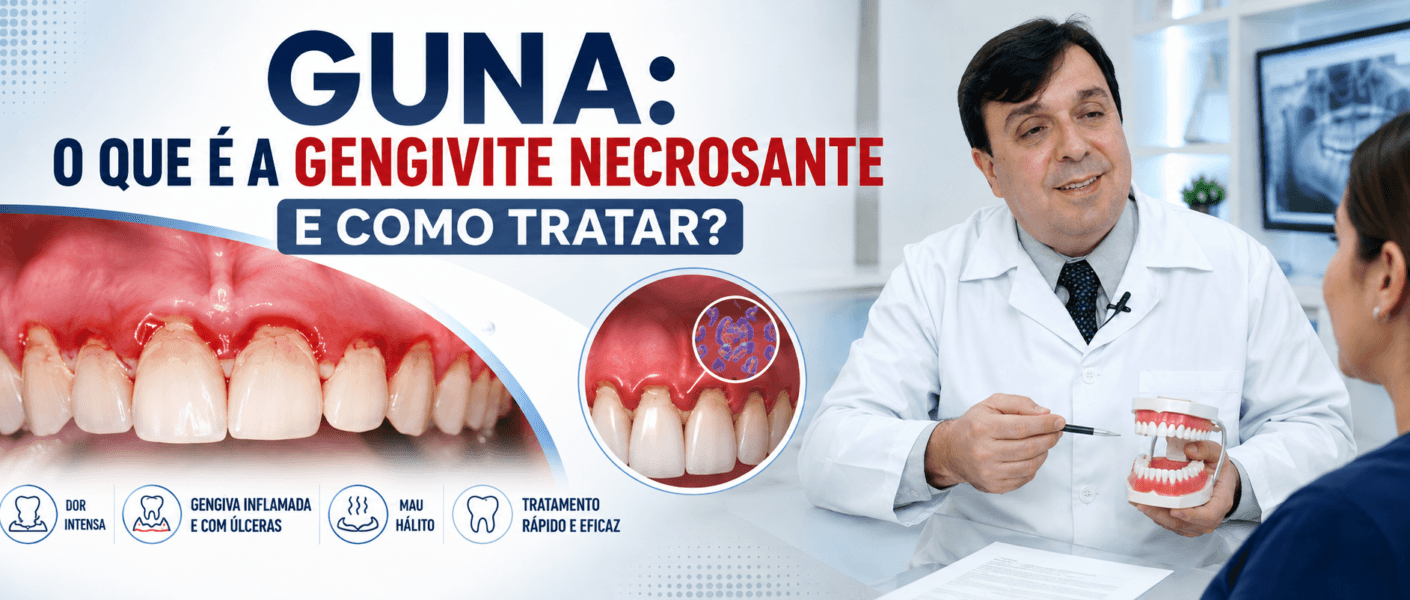 GUNA Entenda a Gengivite Necrosante