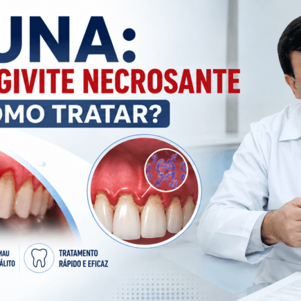 GUNA Entenda a Gengivite Necrosante
