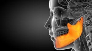 prognatismo mandibular