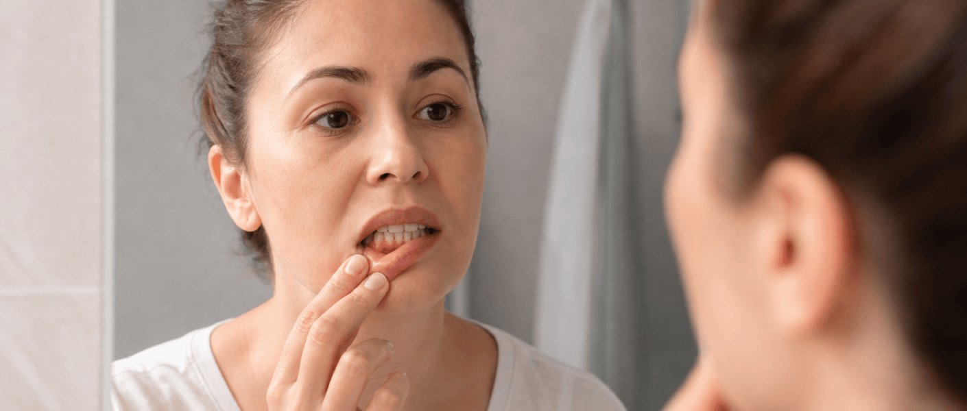 Perda óssea dentária
