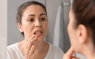 Perda óssea dentária