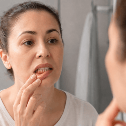Perda óssea dentária