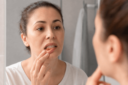 Perda óssea dentária
