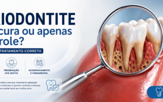 Periodontite