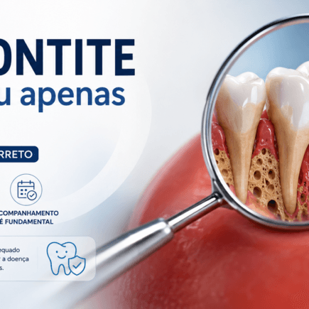 Periodontite