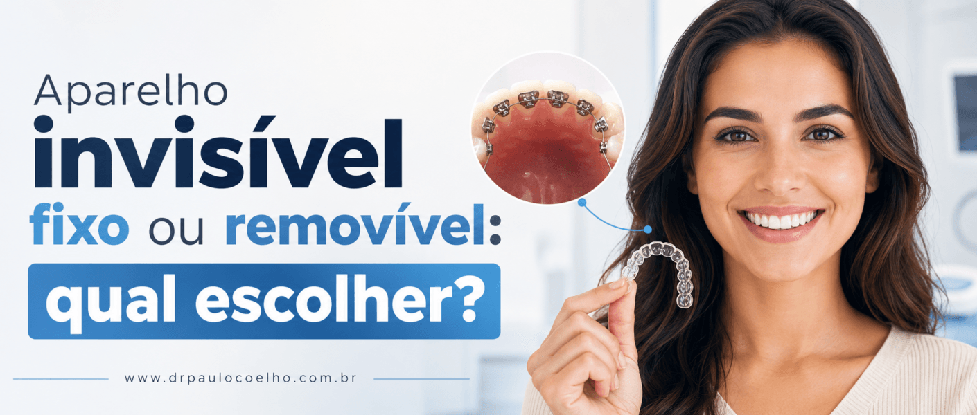 Aparelho invisível fixo ou removível