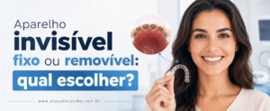Aparelho invisível fixo ou removível