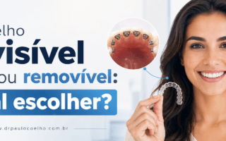 Aparelho invisível fixo ou removível
