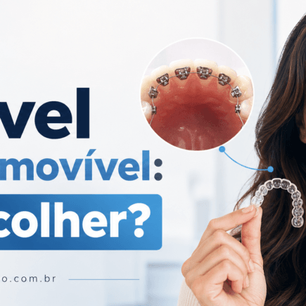 Aparelho invisível fixo ou removível