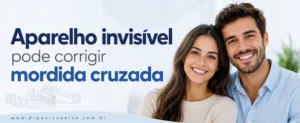 Aparelho invisível pode corrigir mordida cruzada