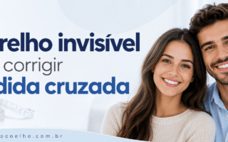 Aparelho invisível pode corrigir mordida cruzada
