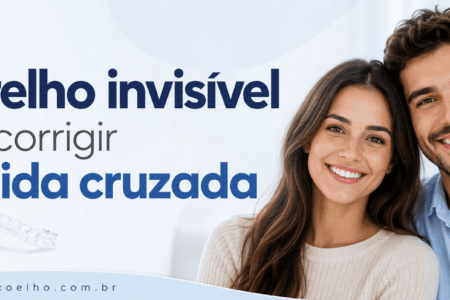 Aparelho invisível pode corrigir mordida cruzada