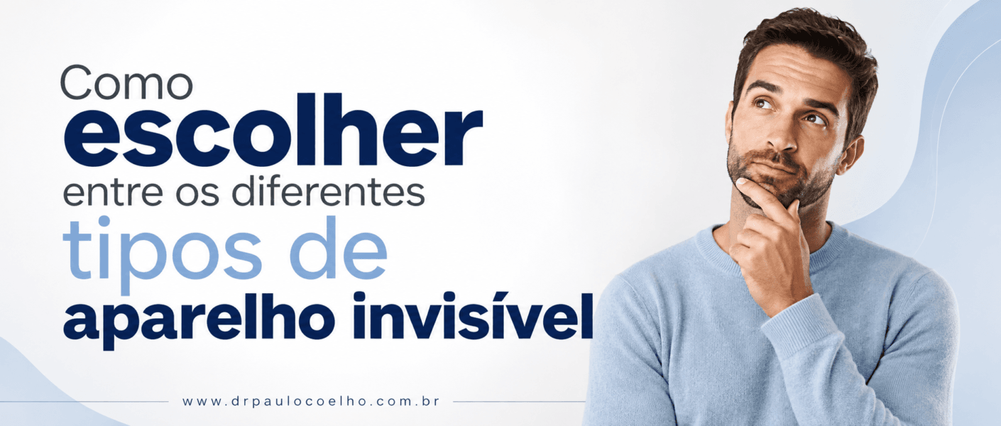 Como escolher entre os diferentes tipos de aparelho invisível