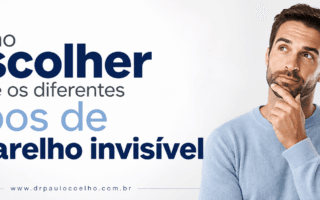 Como escolher entre os diferentes tipos de aparelho invisível