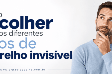 Como escolher entre os diferentes tipos de aparelho invisível
