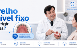 Existe aparelho invisível fix