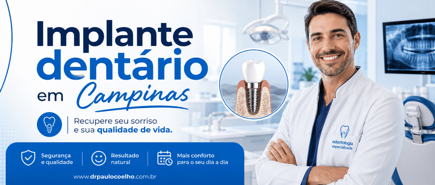 Implante dentário em campinas