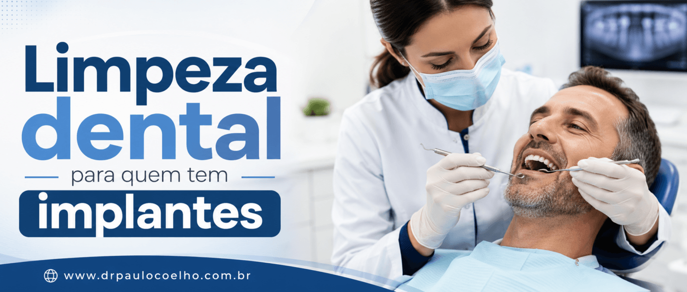 Limpeza dental para quem tem implantes