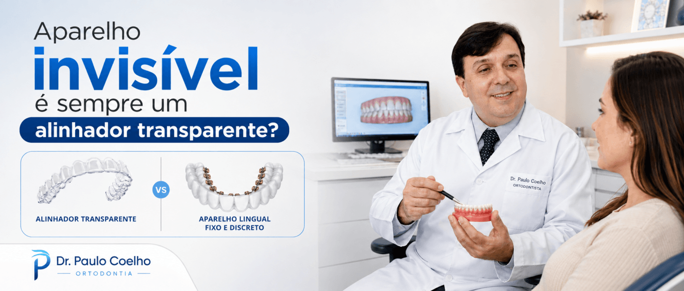 aparelho invisível é alinhador transparente