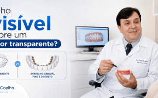 aparelho invisível é alinhador transparente