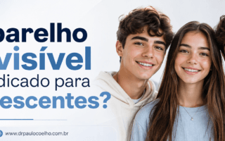aparelho invisível é indicado para adolescentes
