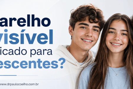 aparelho invisível é indicado para adolescentes