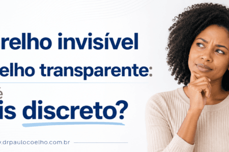 aparelho invisível ou aparelho transparente
