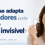 quem não se adapta aos alinhadores pode usar outro aparelho invisível