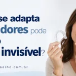 quem não se adapta aos alinhadores pode usar outro aparelho invisível