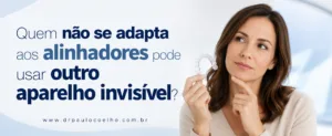 quem não se adapta aos alinhadores pode usar outro aparelho invisível