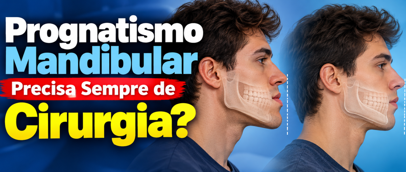 Prognatismo Mandibular Precisa Sempre de Cirurgia?